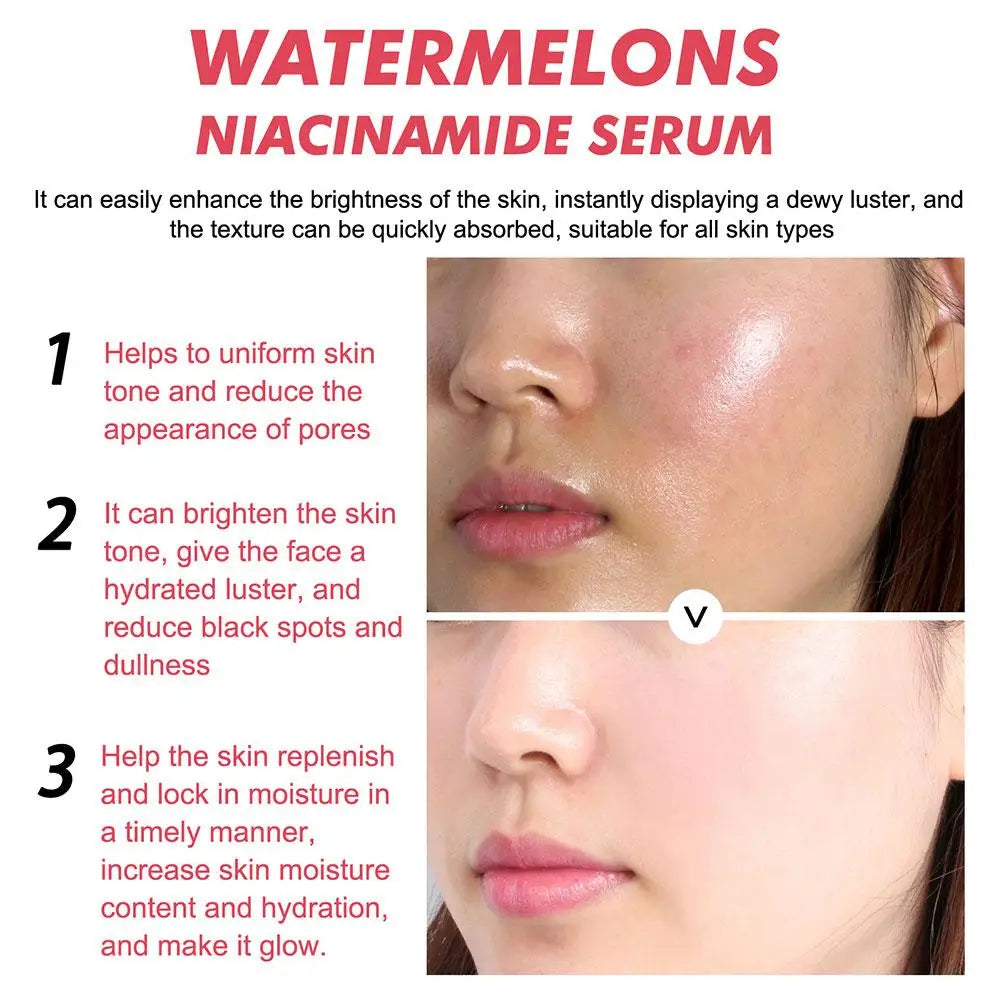 1/3pcs Watermelon nicotinamide Light Bulb serum deep Moisturizing Skin Brightening Face lightning Essence skin care for women