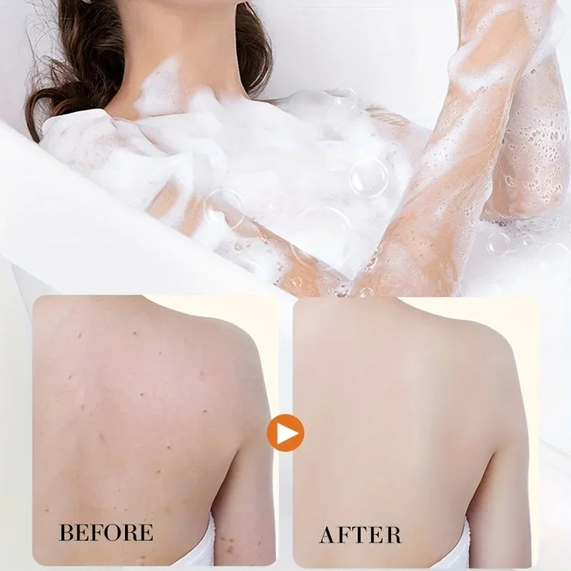 1/2/3 PCS Turmeric Kojic Acid Glow Soap Dark Spot Acne Removal Even Skin Tone Mositen Smooth Skin Deep Cleansing Handmade Soap