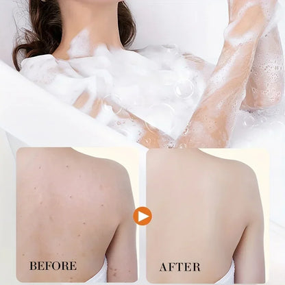 1/2/3 PCS Turmeric Kojic Acid Glow Soap Dark Spot Acne Removal Even Skin Tone Mositen Smooth Skin Deep Cleansing Handmade Soap