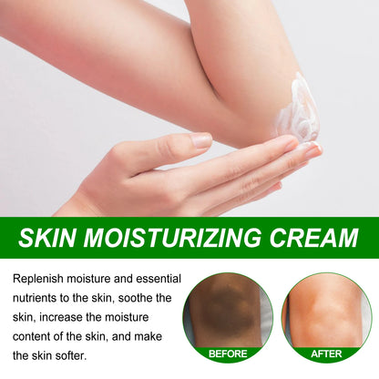 Retinol Whitening Cream for Dark Skin Knee Buttocks Underarm Butt Inner Brightening Private Part Remove Melanin Bleaching Cream