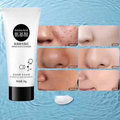 Amino Moisturizes Acid Facial Cleanser Deeply Cleans Dirt Controls Oil Enriches Foam