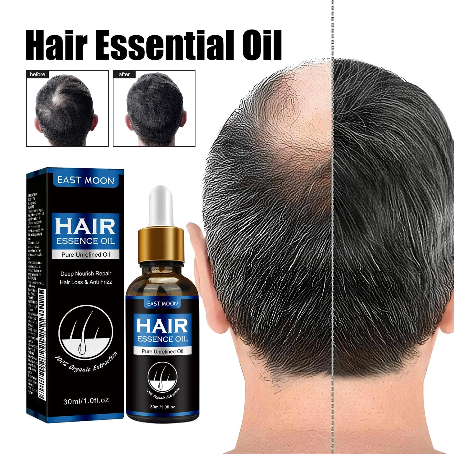 Rosemary Hair G-rowth Essential Oil Deep Nourishing Scalp Nutrient Anti Hair Loss Repair Damage Reg-rowth Oil Thinning Treatment