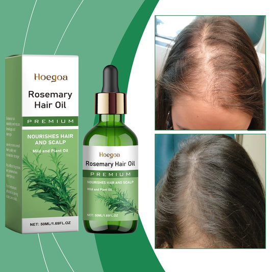 Rosemary Hair Essential Oil Scalp Hair Strengthening Oil Hair Thinning Treatment Nourishing Treatment Split Ends Dry All Types