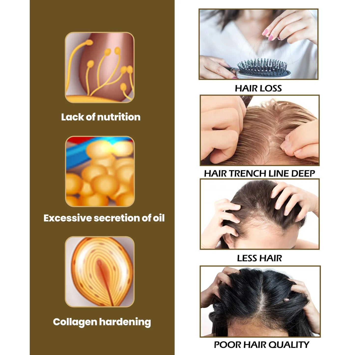 Fast Hair Growth Spray Fermented Rice Water Serum Prevent Thinning Dry Frizzy Repair Refreshing Anti Hair Loss Treatment Product