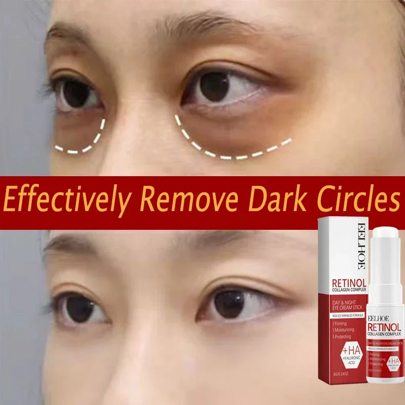 Retinol Eye Cream Collagen Multibalm Stick Reduce Wrinkles Eye Bag Hyaluronic Acid Anti Dark Circle Puffiness Eye Care Products