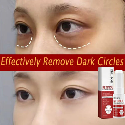 Retinol Eye Cream Collagen Multibalm Stick Reduce Wrinkles Eye Bag Hyaluronic Acid Anti Dark Circle Puffiness Eye Care Products