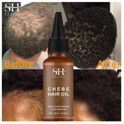 Fast Hair Growth Oil African Crazy Traction Alopecia Chebe Hair Mask Anti Hair Break Hair Strengthener Hair Loss Treatment Spray