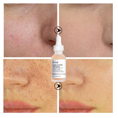 Lactic Acid Large Pores Removal Serum Facial Fast Eliminate Pore Shrinking Essence Firm Skin Moisturizing Hydration Care Product