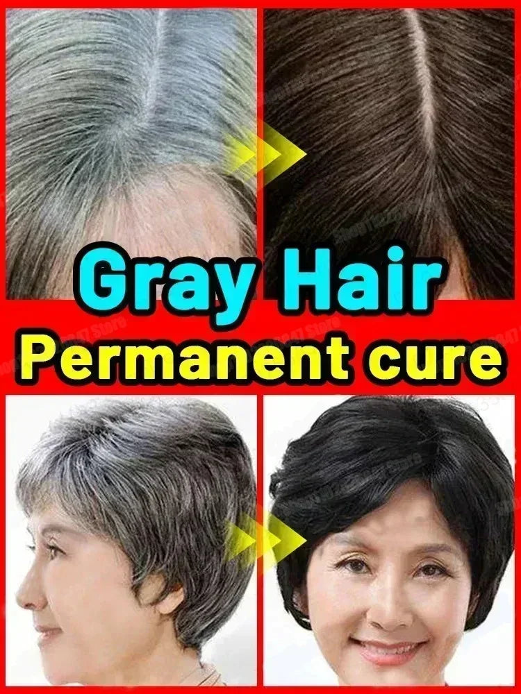 White To Black Gray White Hair Serum Natural Color Repair Nourishessence Anti-gray Care For Men Women