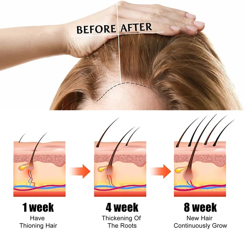 Fast Hair Growth Oil Africa Crazy Traction Alopecia Serum Anti Hair Break Thicken Hair Loss Treatment Spray For Man Women 60ML