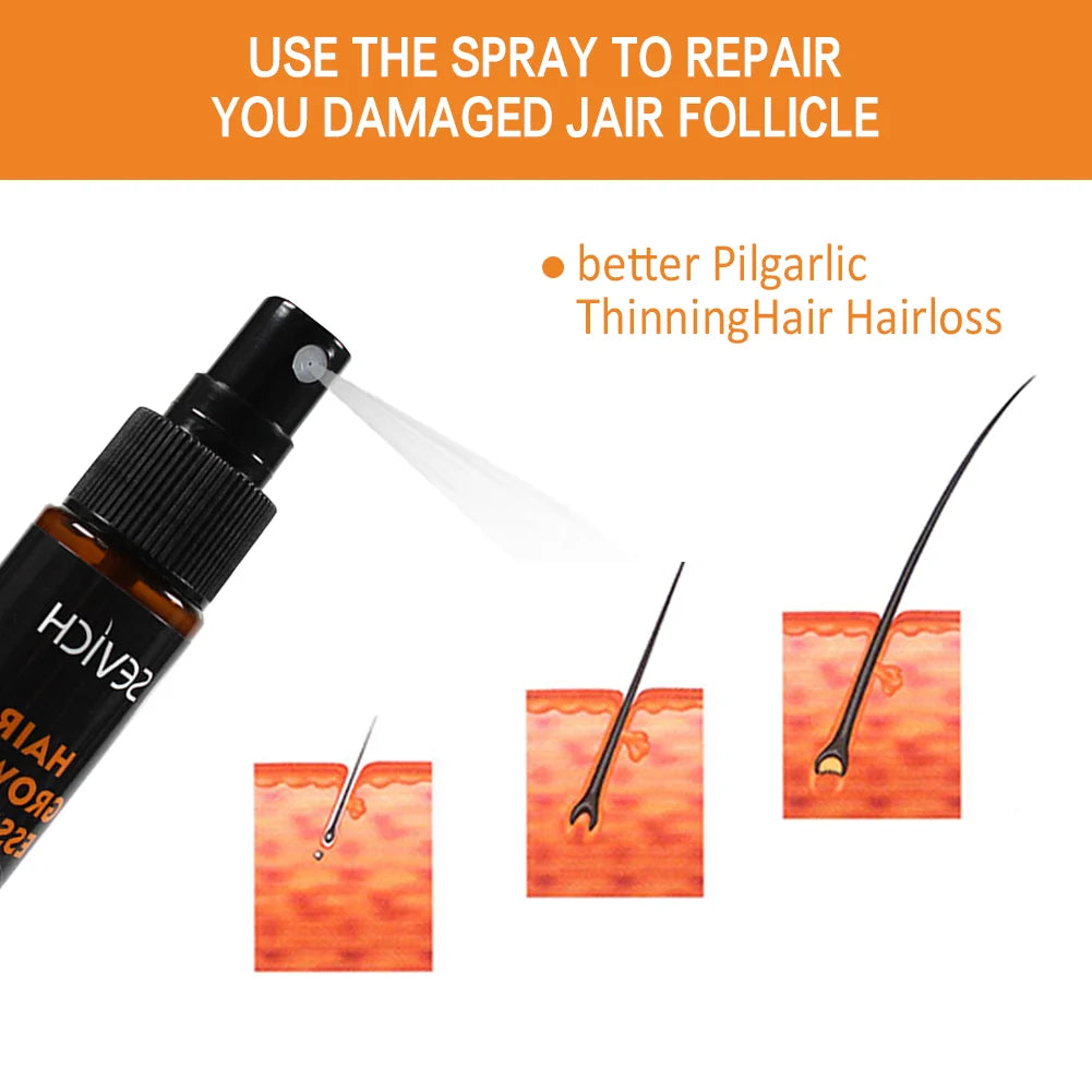 Natural Ginger Hair Growth Essence Oil 30ml Anti Alopecia Dense Regrowth Sprayer Powerful Hair Growth Serums Hair Loss Products