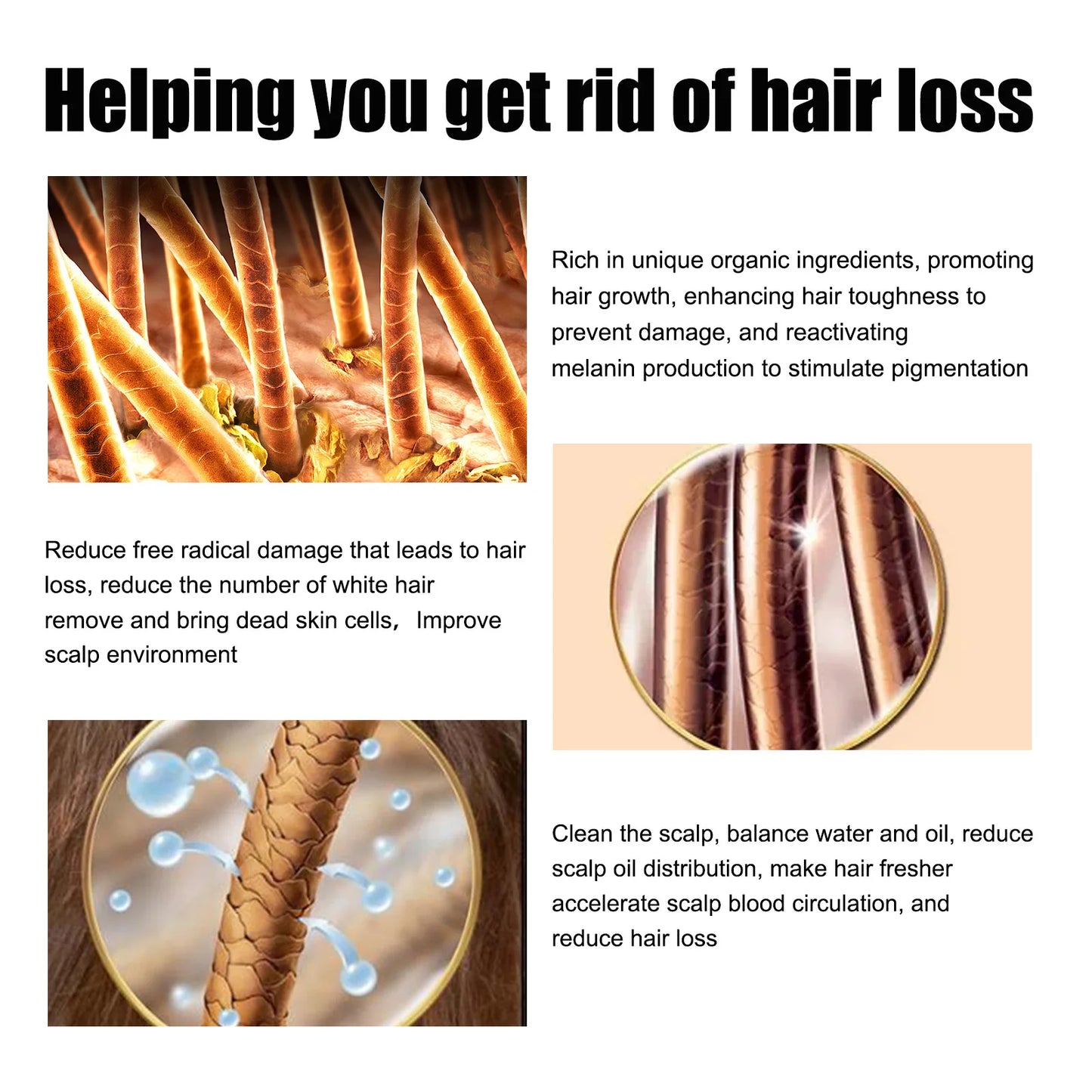 Rosemary Hair G-rowth Essential Oil Deep Nourishing Scalp Nutrient Anti Hair Loss Repair Damage Reg-rowth Oil Thinning Treatment