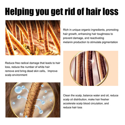 Rosemary Hair G-rowth Essential Oil Deep Nourishing Scalp Nutrient Anti Hair Loss Repair Damage Reg-rowth Oil Thinning Treatment