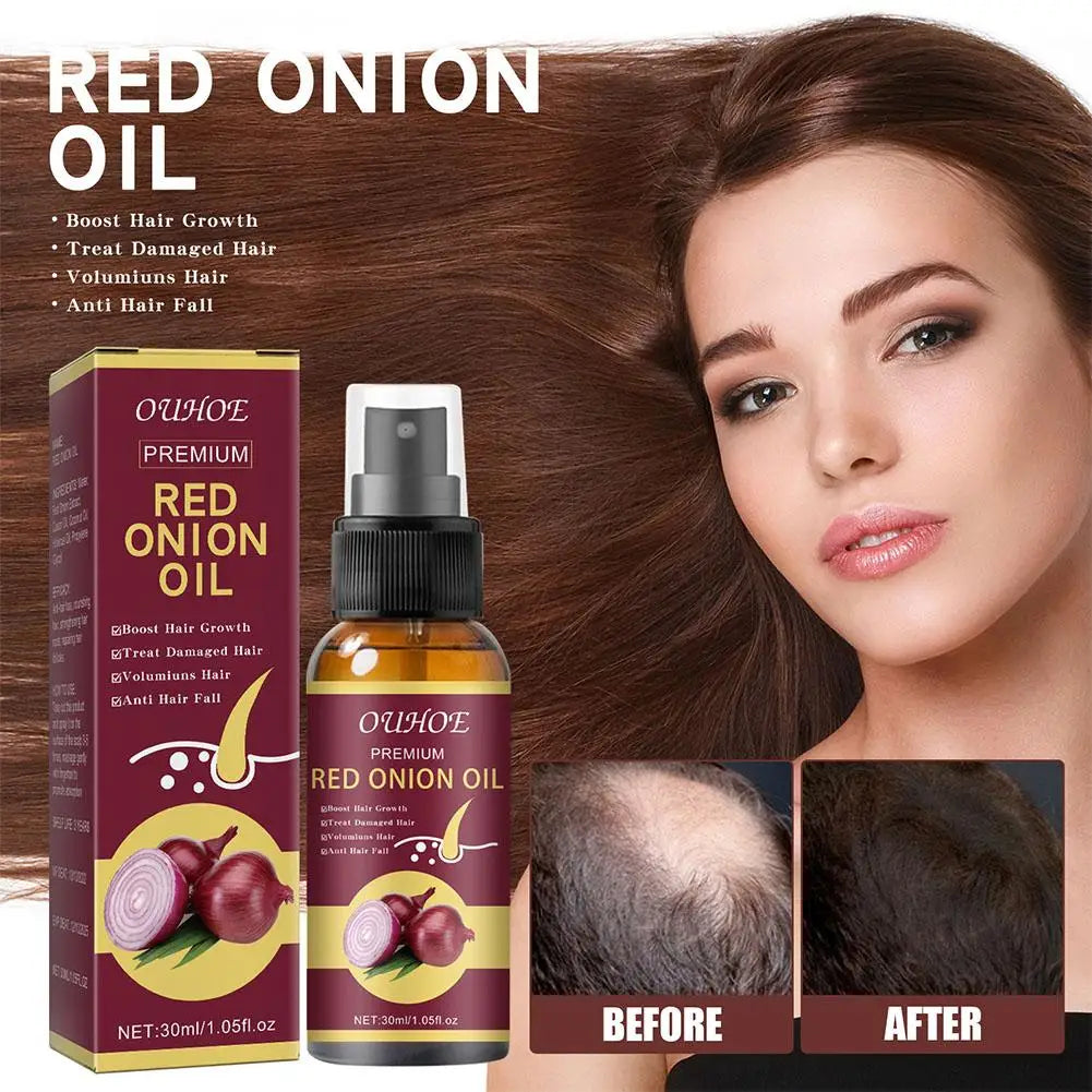 5/3/1pcs Red Onion Essential Oil Spray For Hair Care,Rice Water Moisturizing Hair Spray,Damaged Hair Treatments Hair Care
