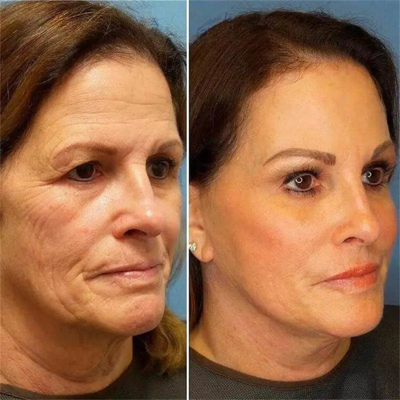 Instant Remove Wrinkle Cream Retinol Facial Anti Aging Firming Lifting Fade Fine Lines Moisturizing Whitening Repair Skin Care