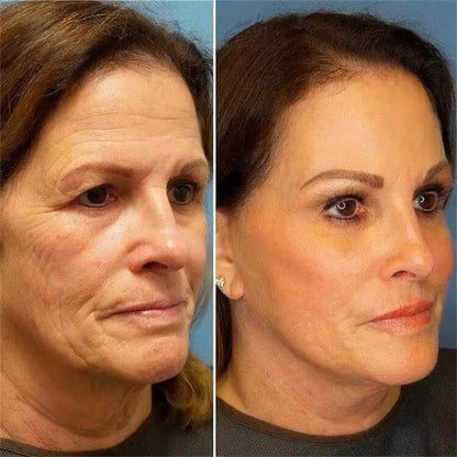 Instant Remove Wrinkle Cream Retinol Facial Anti Aging Firming Lifting Fade Fine Lines Moisturizing Whitening Repair Skin Care