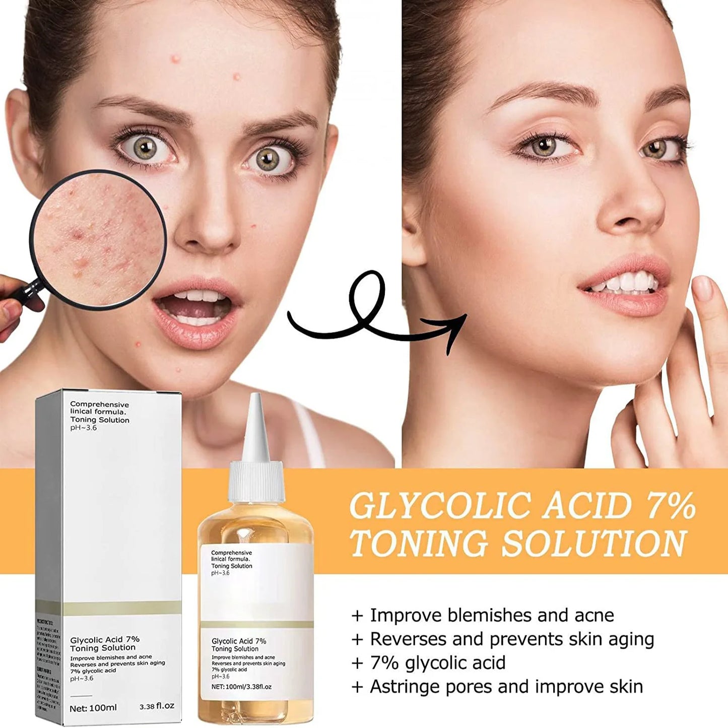 Glycolic Acid 7% Toning Solution To Remove Acne Moisturize Skin Rejuvenating Lotion Gentle Glycolic Acid Tone Exfoliating Toner