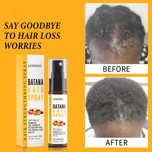 30ml Batana Anti Hair Loss Spray 50ml Batana Hair Growth Essence Oil Repair Damaged Prevent Split Ends Fast Regrowth Hair Oil