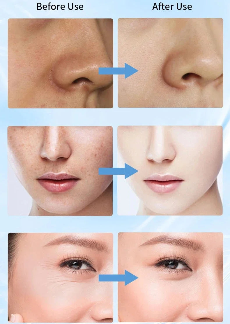 Hoygi Niacinamide Facial Serum Vitamin B3 Wrinkles Pigment Dark Spot Removal Correcting Glow Serum Face Whitening Moisturizer