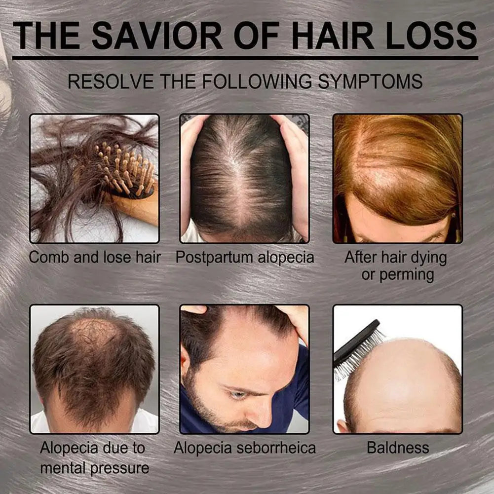 30ml Rosemary Essential Oil Hair Care Oils Pure Natural Hair Essential Oils For Nourish Shiny Hair Healthy Care