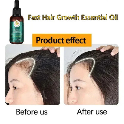 Hair Fast Growth And Care Essential Oil Natural Ginger Hair Regrowth Products Serum  Care Hair Loss Series