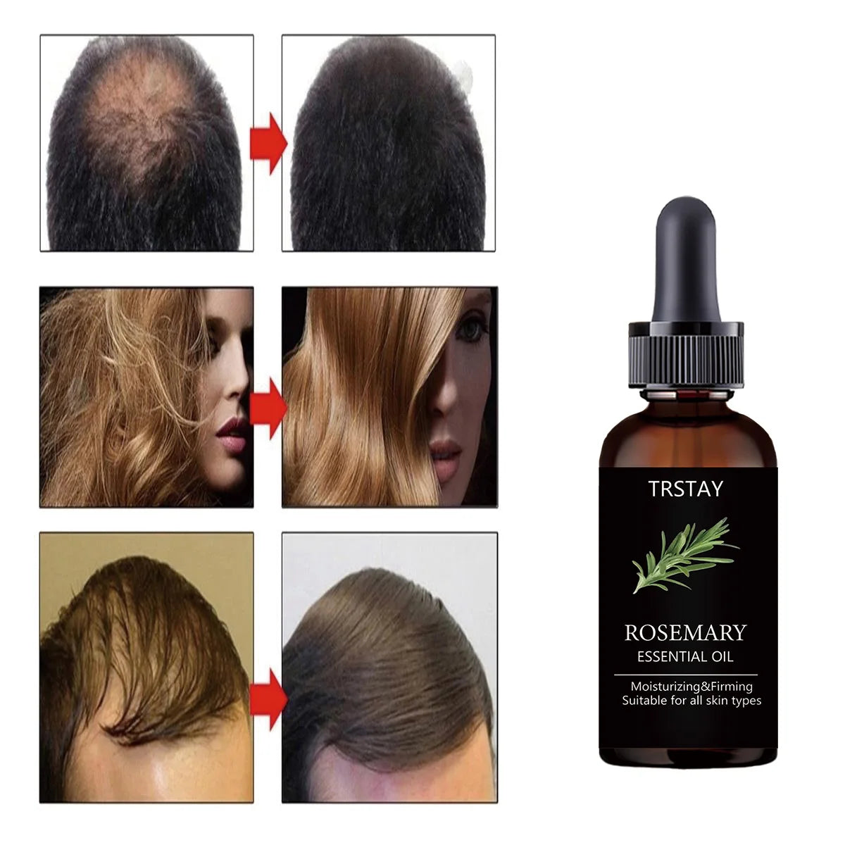 TRSTAY Rosemary Essential Oil for Hair Care Improves Damaged Hair Dredges Blocked Follicles Activates And Growth Lubricates Hair