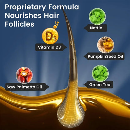 DHT Blockers for Men - Contains Saw Palmetto & Biotin To Promote Natural Hair Growth, Increase Vitality, and Maximize Absorption