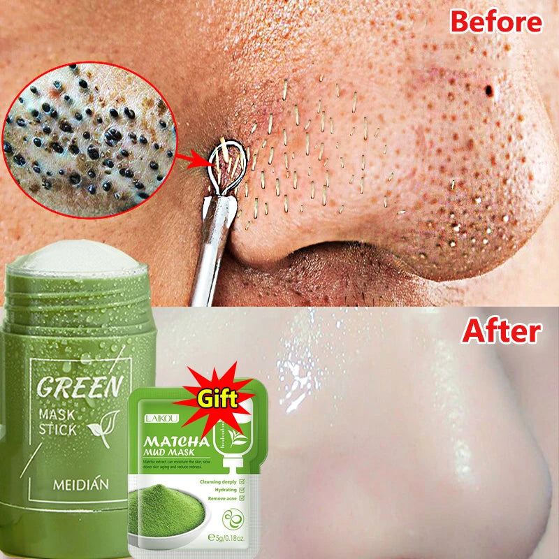 Remove Blackhead Mud Mask Green Tea Face Clean Stick Dispel Pimple Blemish Shrink Pores Oil Control Exfoliating Whiten Skin Care
