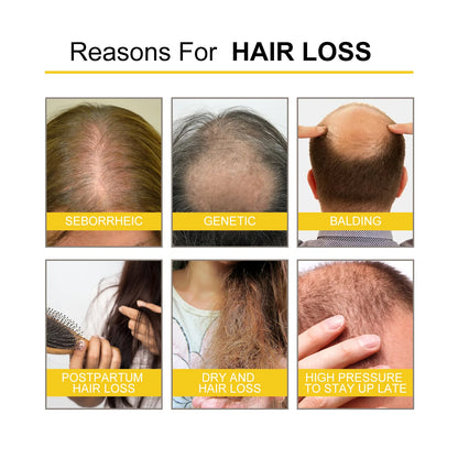 Hair Growth Essential Oil Treatment Seborrheic Alopecia Follicle Repairing Reduce Hairline Baldness Dense Growing Hairs Lotion