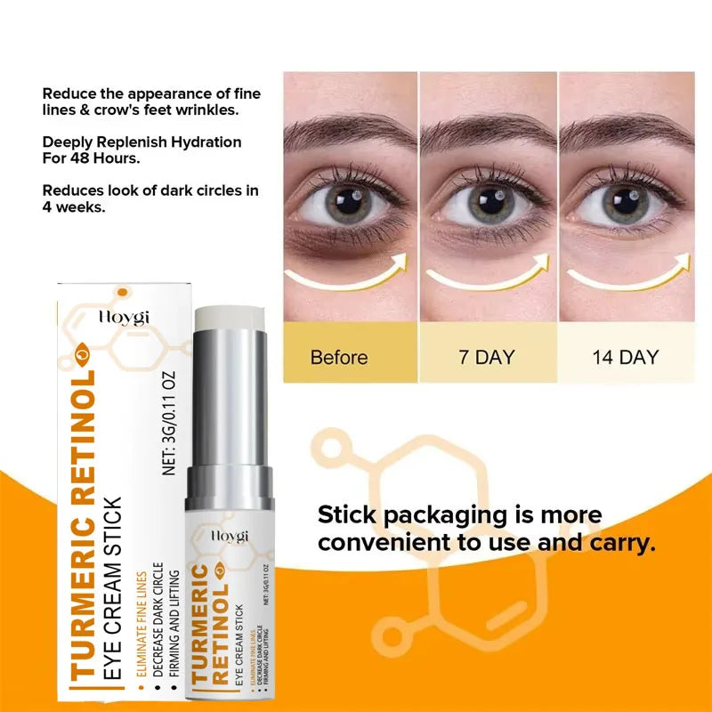Instant Eye Bag Remove Eye Cream Anti Fat Particles Dark Circles Puffiness Fade Fine Lines Lift Brighten Korean Beauty Eye Care