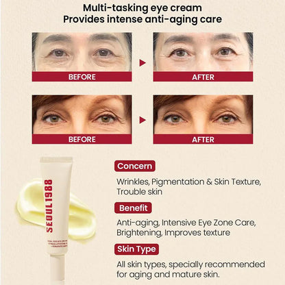 Seoul 1988 Eye Cream, Retinol Serum, Anti-Wrinkle, Anti-Aging, Skin Elasticity, Pigmentation, Niacinamide, Korean Skincare