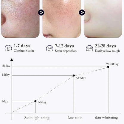 Removal Dark Spots Whitening Freckle Cream Leaving skin looking brighter clearer and more luminous prevent future discoloration