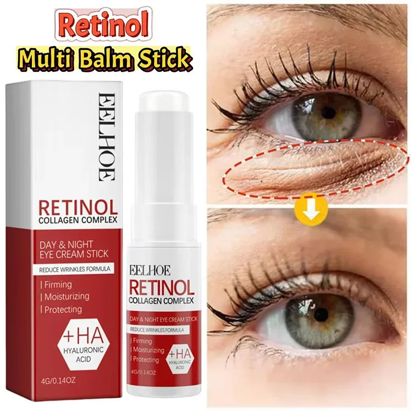 Retinol Eye Cream Collagen Multibalm Stick Reduce Wrinkles Eye Bag Hyaluronic Acid Anti Dark Circle Puffiness Eye Care Products
