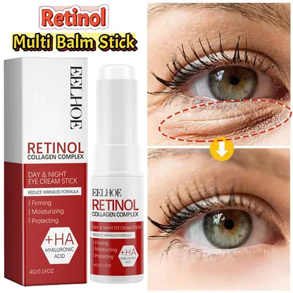Retinol Eye Cream Collagen Multibalm Stick Reduce Wrinkles Eye Bag Hyaluronic Acid Anti Dark Circle Puffiness Eye Care Products