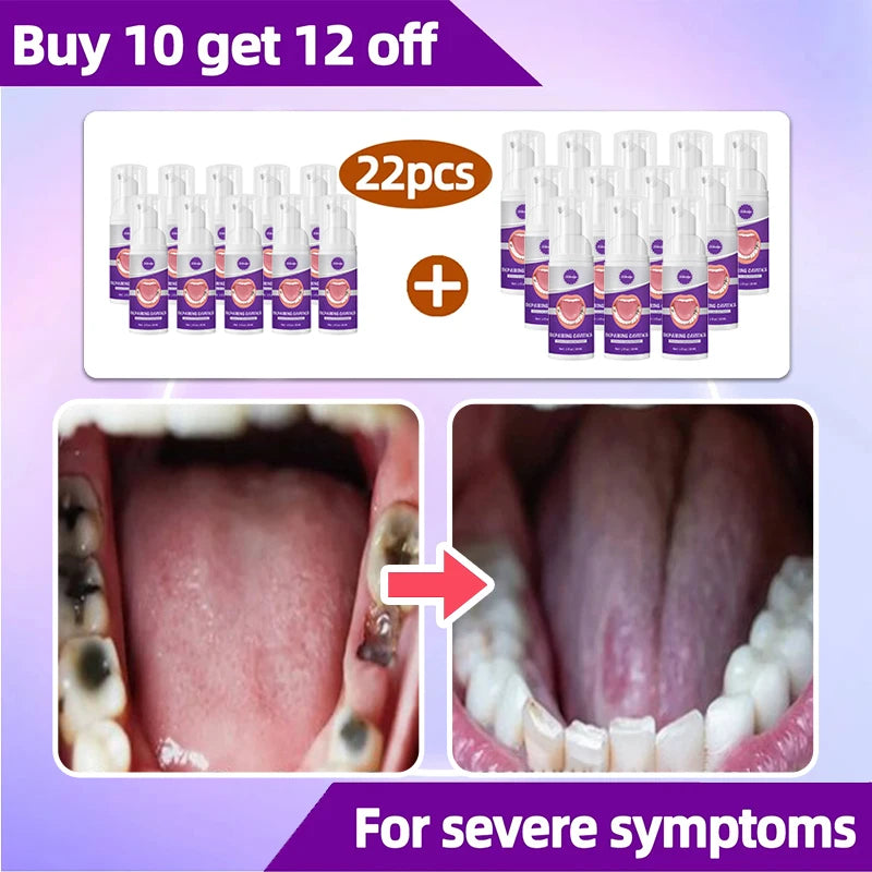 tooh Decay repair Suitable for all ages