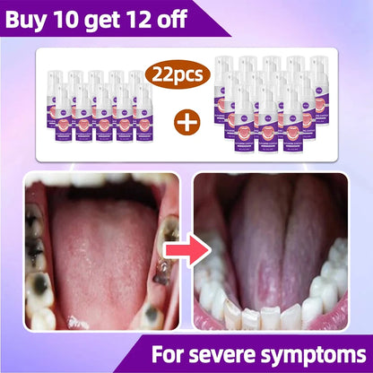 tooh Decay repair Suitable for all ages