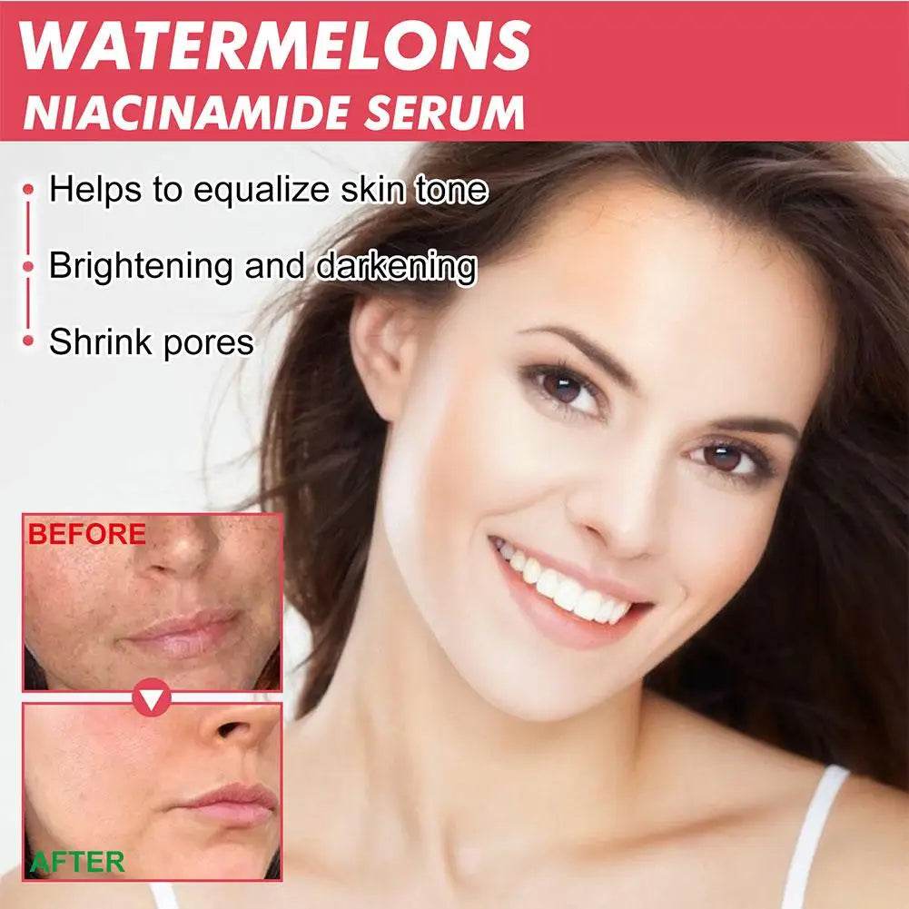 1/3pcs Watermelon nicotinamide Light Bulb serum deep Moisturizing Skin Brightening Face lightning Essence skin care for women