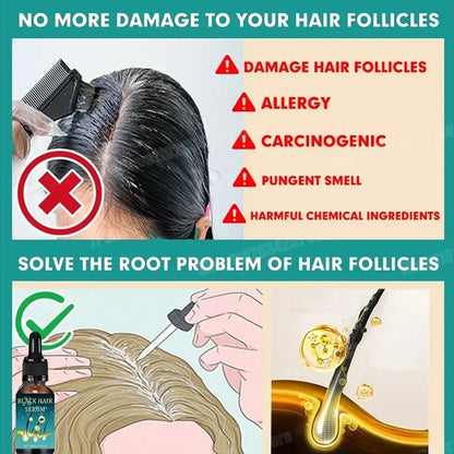 Natural Anti Gray Hair Serum - Repair White & Darkening Hair | Nourishing Hair Care Remedy