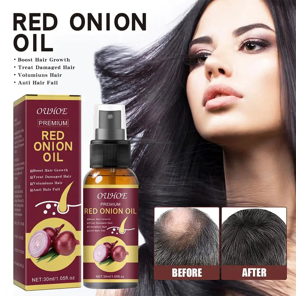 Red Onion Hair Growth Essential Oil Hair Care Spray Prevent Hair Loss Nourish Hair Roots Improve Hair Texture Hair Care Products