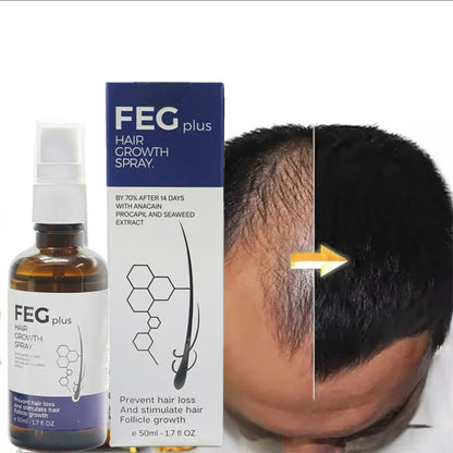 2pcs FEG hair growth spray original Organic Anti Hair Loss Hair Growth Treatment Oil For Thicker Long Hair -50ML