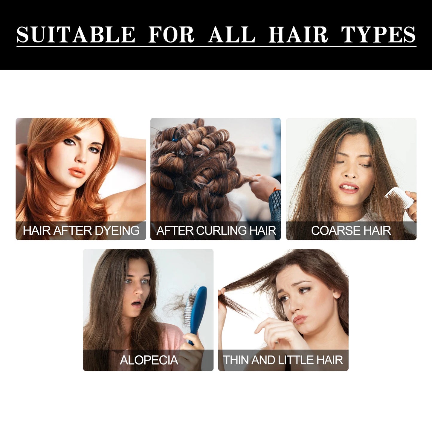 Hair Growth Oil Fast Hair Growth Effective Treatment for Baldness Hereditary Hair Loss Postpartum Hair Loss Seborrheic Hair Loss