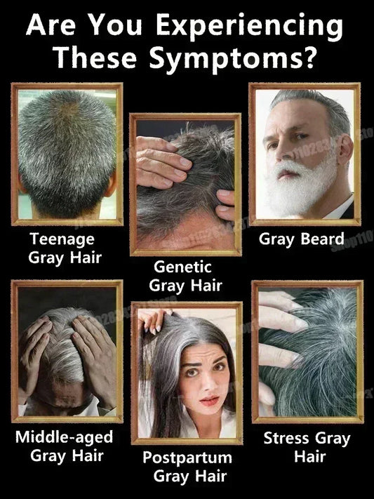 Natural Anti Gray Hair Serum | Nourishing Hair Care Remedy - Repair White & Darkening Hair