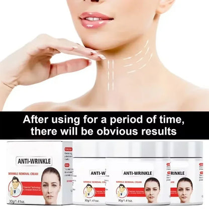Instant Anti Wrinkle Aging Effect Remove Facial Wrinkles Fade Fine Lines Firming Tightening Face Skin Care Korea Cosmetic