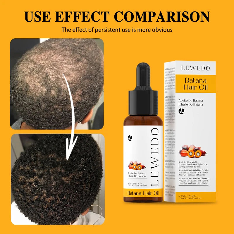 Hair Growth Essential Loss Batana Oil Regrowth Strengthen Roots Hair Care Oil Hair Nourishes Scalp Improve Scalp Circulation