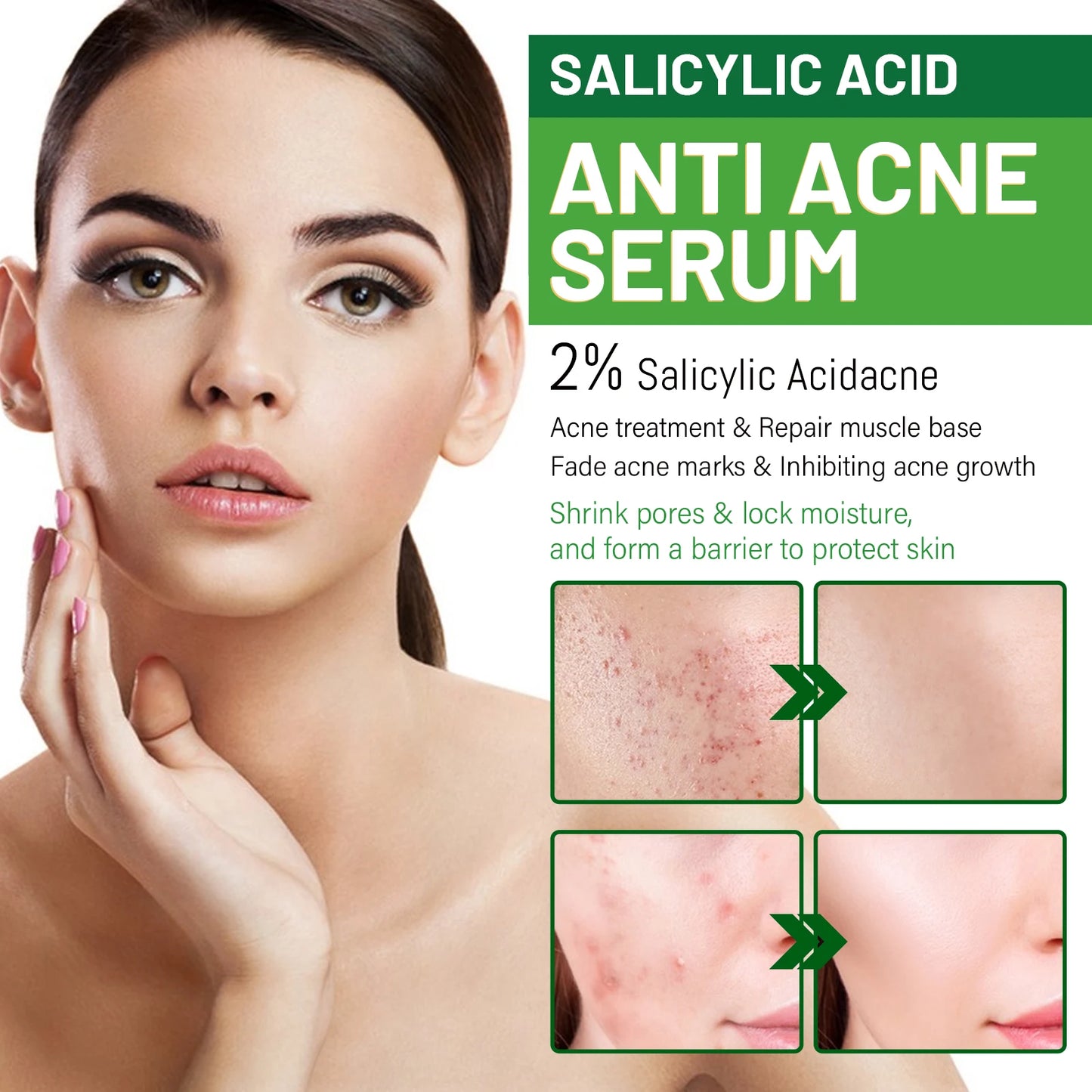 Salicylic Acid Anti Acn-e Serum Essence Controls Oil Shrinks Pores Removes Blackheads & Acne Repairs Acne Marks Moisturizes Face