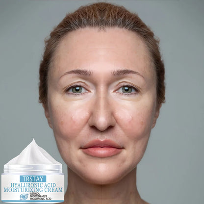 Hyaluronic Acid Moisturizing Cream Retinol Nicotinamide