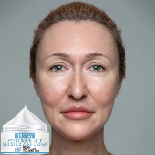 Hyaluronic Acid Moisturizing Cream Retinol Nicotinamide