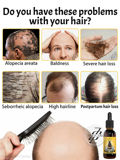 2025 bestseller, Hair growth oil for men, accelerates hair growth, no longer troubled by baldness, increases hair volume