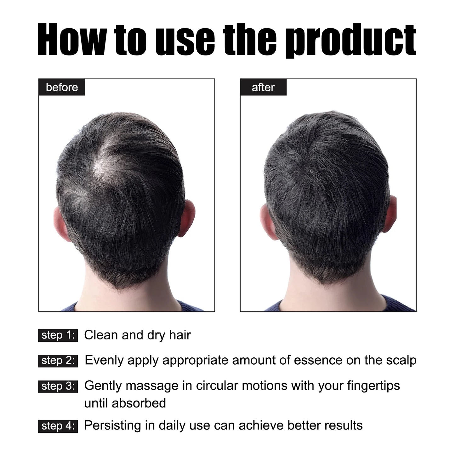 Rosemary Hair G-rowth Essential Oil Deep Nourishing Scalp Nutrient Anti Hair Loss Repair Damage Reg-rowth Oil Thinning Treatment