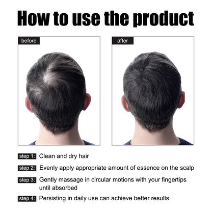 Rosemary Hair G-rowth Essential Oil Deep Nourishing Scalp Nutrient Anti Hair Loss Repair Damage Reg-rowth Oil Thinning Treatment